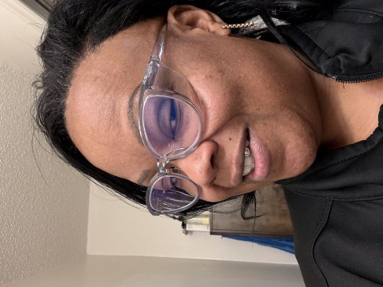 Picture of Love these cat eye toggles!!!